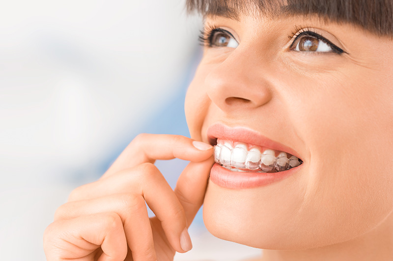 Invisalign in Omaha