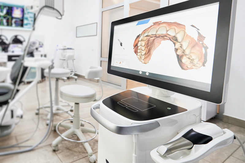 Intra-Oral Scanner in Omaha